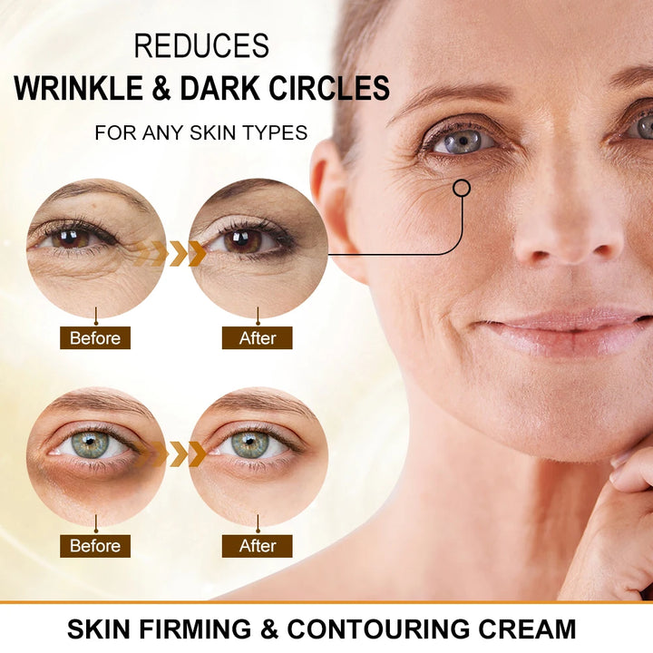 Peptide Anti-Dark Circle Eye Cream - Caffeine-Infused for Eye Bags, Wrinkle Reduction, Firming & Brightening